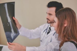 Broken Bone Lawyer in San Jose California