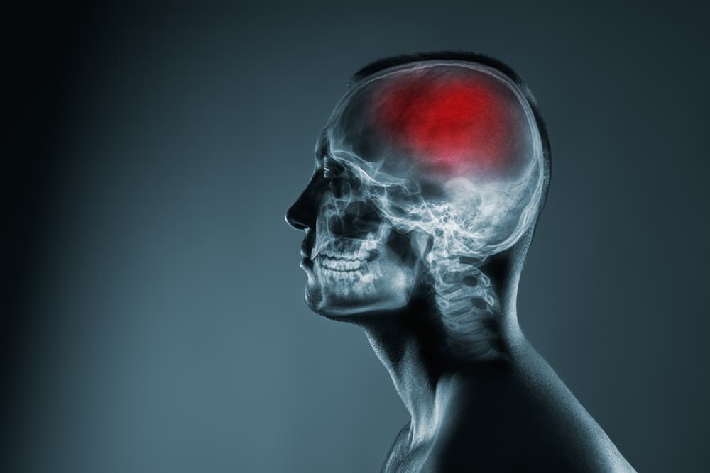 Brain Damage